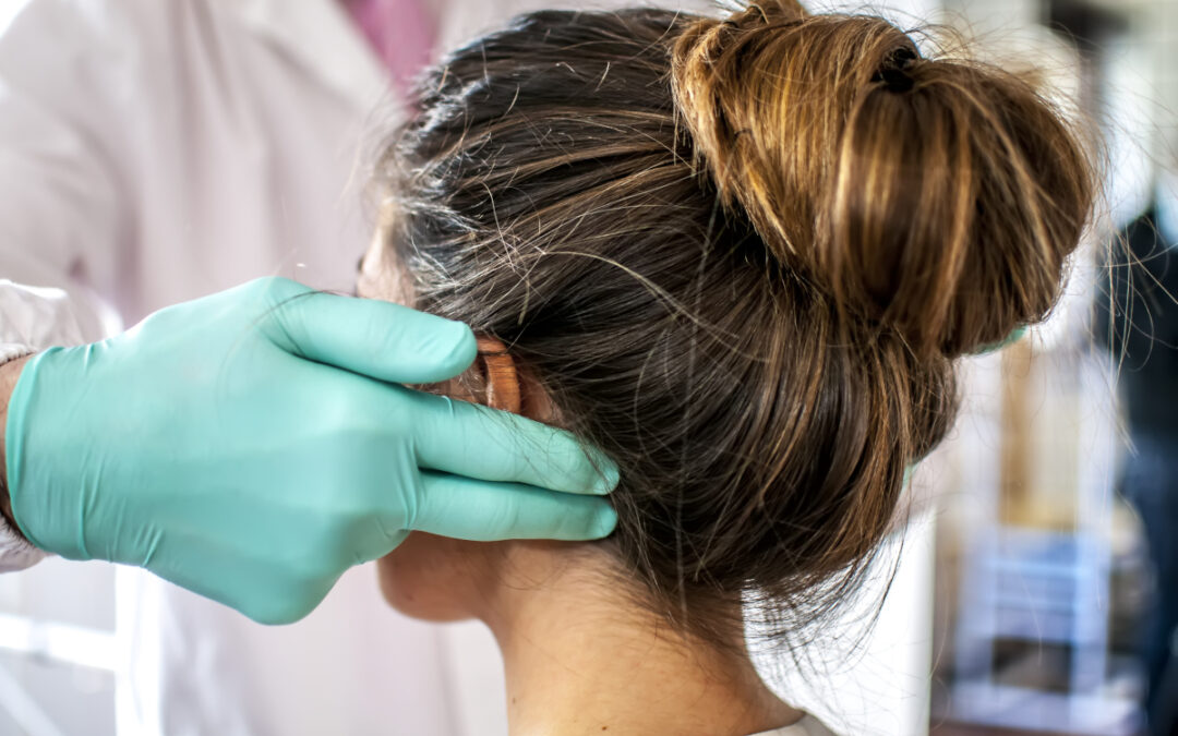 Zapalenie mieszka włosowego